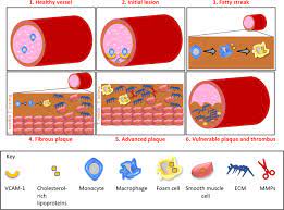 Mouse Models Of Atherosclerosis And Their Suitability For The Study Of Myocardial Infarction Springerlink