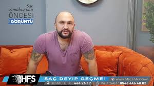 Sac Simulasyonu Sikayet Memnuniyet Youtube