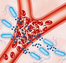 Coding Yesterday S Nomenclature Today Coding Yesterday S Nomenclature Today Coding Noninfectious Sirs In Icd 9 Cm Icd 10 Cm