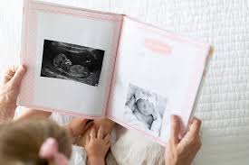 Buy Lil Peach First 5 Years Baby Memory Book Cherish Every Precious Moment Of Your Baby Perfect Baby Shower Gift Pink And Peach Confetti Polka Dots Online In Turkey B01by1upt4
