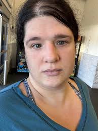 Dealing with UTI, eye infection, and risk of sepsis