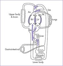 Image result for Fetal Circulation