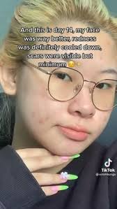 Abel lazo (lazoabel)