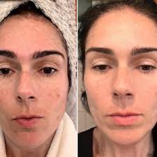 Rejuvenating and Anti-Aging Collagen Face Moisturizer with Stem Cells