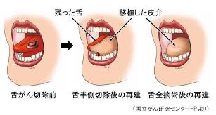 Japanese dictionary search results for じしょ. å €ã¡ãˆã¿ èˆŒ ç™Œ ãƒ–ãƒ­ã‚° Moji Infotiket Com
