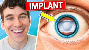 Hairline Designing For Hair Transplant