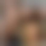 Image result for Onychotillomania feet