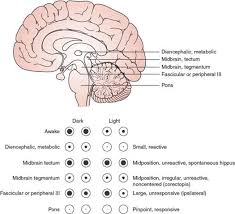 Image result for Neurologic Lesion Localization