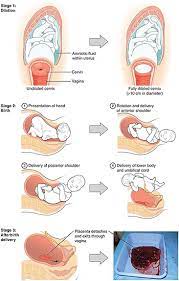 Childbirth Wikiwand