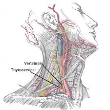 Most cases resolve without sequelae with early and appropriate treatment. Subclavian Artery Wikidoc