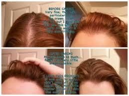 Wonderful Caboki Hair Loss Concealer Review