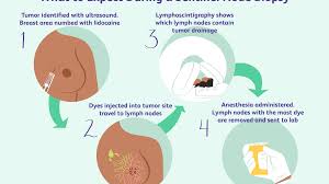 When lymph nodes swell in a particular location like the neck, it could indicate a minor infection like a common cold, or something more serious such as an injury, inflammation, or even cancer. Lymph Node Positive Breast Cancer Symptoms And Treatment