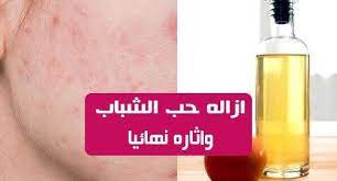 ازاله حب الشباب واثاره نهائيا اليك افضل الطرق لعلاج حب الشباب نهائيا وبسرعة قد تكونين متعبة من تلك البثور المزعجة لقد وصلت إلى المكان الصحيح في هذه المقال khal