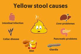 Pancreatic cancer fatty stool picture. Yellow Poop 7 Possible Causes What To Do Tua Saude