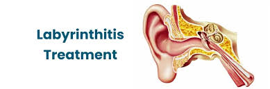 Image result for Bacterial Labyrinthitis