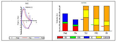 Image result for Lung Function Questionnaire