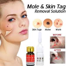 Mole Amp Skin Tag Removal Solution Let S Face It Moles Skin Tags Amp Warts Are Unsightly Bothersome A Skin Tag Removal Skin Tag Skin Tag Removal Cream
