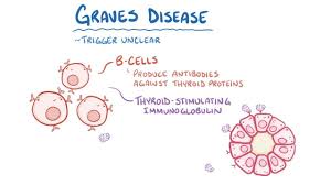 35 715 просмотров 35 тыс. Graves Disease Video Explanation Osmosis