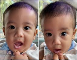 Oral thrush paling sering terjadi pada bayi atau balita, bahkan bayi yang baru lahir sekalipun. Bila Baby Aidan Kena Kulat Susu Oral Thrush Hafiz Rahim
