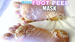 For those who haven't heard of baby foot ($25, babyfoot.com), it's an exfoliating foot peel that comes in the form of plastic booties. I Tested A Crazy Foot Peel Mask Youtube