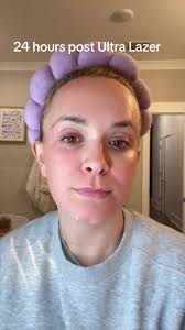 Recovery Precision Tx Laser