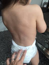 There's no specific treatment for the rash of roseola, which fades on its own in a short time. The Devil Is Roseola And How I Survived It Jo Lauren
