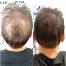 Aykut Ozhan Sac Simulasyonu Ve Microblading Kil Teknigi Uzmani