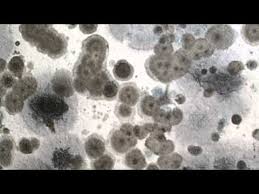Take a nylon bristle brush and scrub the surface area to lift and unsettle the dampened mold. How To Get Rid Of Mold In The Basement 8 Easy Steps Oh So Spotless