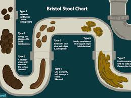 Stool color guide and chart. An Overview Of The Bristol Stool Chart