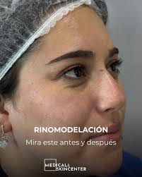 ✨ Transforma tu piel con la Dra. Sandra Mena ✨ Si quieres verte y sentirte  mejor, la medicina estética te ofrece soluciones seguras y efectivas. La  Dra. Sandra Mena, médico cirujano especialista