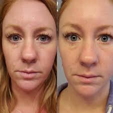 Unexpected skincare discovery for puffy face and redness