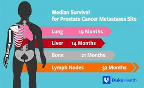 This is more commonly used to see if prostate cancer has come back after treatment, rather than cancer that's spread from the prostate to other parts of the body. Men With Prostate Cancer Metastasized To The Liver Have Worst Overall Median Survival Cancer Therapy Advisor