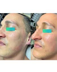 Abbie Major (@abbieskinlove) • Instagram photos and videos