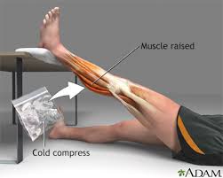 A pulled arm muscle often causes swelling at the site of the tear. Muscle Strain Treatment Information Mount Sinai New York