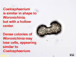 Image result for Microcoelia physophora