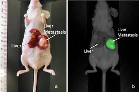 We did not find results for: Humanized Fluorescent Tumor Associated Glycoprotein 72 Antibody Selectively Labels Colon Cancer Liver Metastases In Orthotopic Mouse Models In Vivo