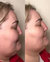 Fresh Faces Aesthetic Clinic