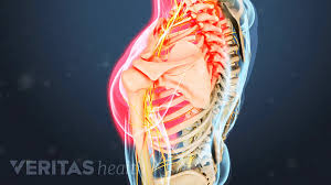 Image of a painful back. Could That Shoulder Pain Really Stem From The Neck