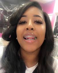 130 Braces colors ideas