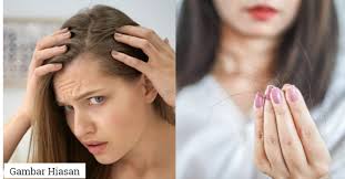 Ada mimpi rambutnya beruban sebagian, beruban sedikit, ada bermimpi mencabut uban. Stres Sebabkan Rambut Mudah Gugur Ini 15 Punca Rambut Gugur Yang Lelaki Dan Perempuan Mesti Tahu