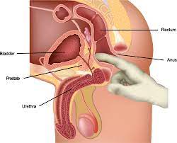 One in seven men in the united states will receive a prostate cancer diagnosis during his lifetime. Understanding My Psa And Dre My Prostate Cancer Coach