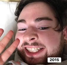 From the year she began to the year we are in now. Our gorgeous Emily 🐷