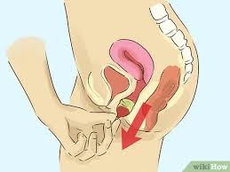 Check spelling or type a new query. 3 Ways To Use A Menstrual Cup Wikihow