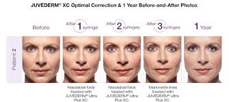 Before & After Cosmetic Treatments West Orange NJ