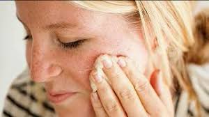 Complete the registration information below. Relief For Your Face Home Remedies Wnep Com