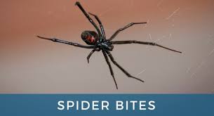 Check spelling or type a new query. Treating Spider Bites In Middle Tennessee At Physicians Urgent Care