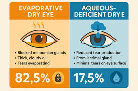 Image result for Dry Eye