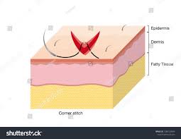 Image result for Corner Stitch