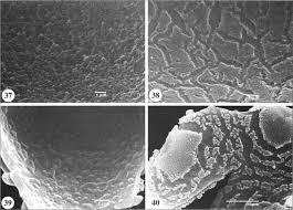 Image result for Hedythyrsus thamnoideus