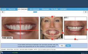 Orthodontic Issues That Clear Aligners Can And Can'T Fix | Byford Smiles